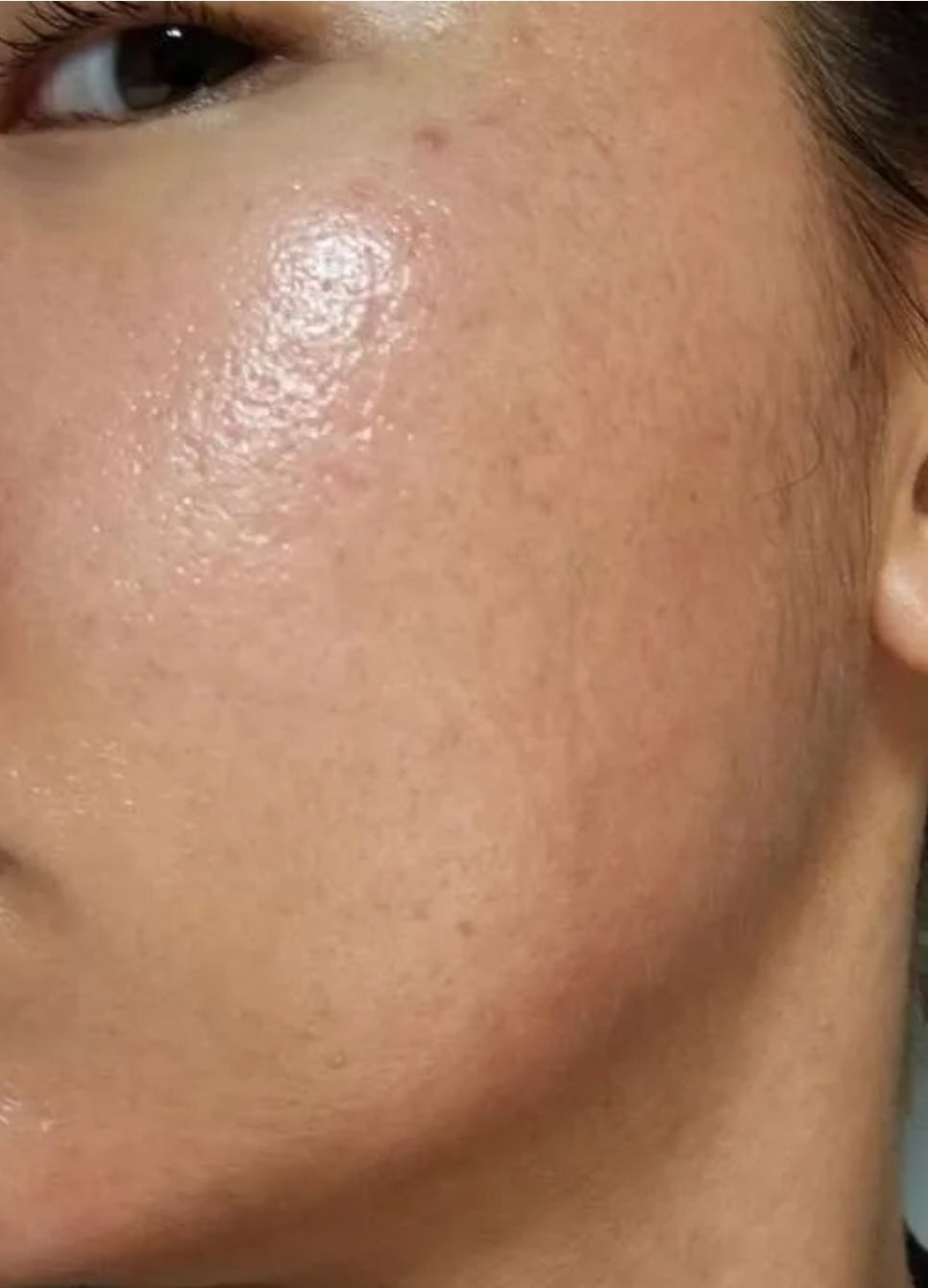 Microneedling with CBD 3 Sessions