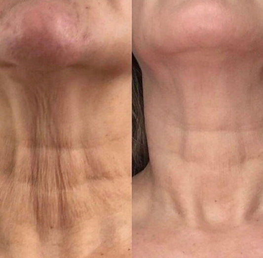 Cool Peel: Face + Neck + Chest  3 Pack